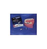 Dentsply 659020 Palodent Sectional Matrix System – Mini Contoured Matrices (50/Pk)